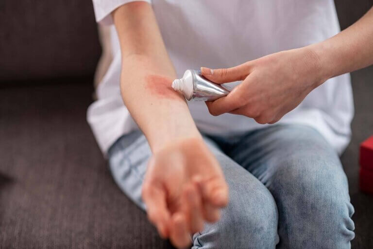 antiseptic cream