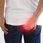 hemorrhoid cream